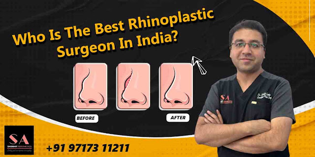 Rhinoplasty surgery in Delhi