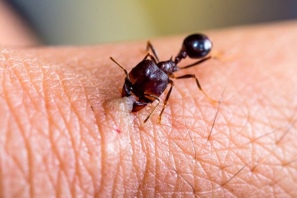 Why An Ant's Bite Hurts So Bad - Wild