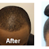Here is the 2 in 1 Hair Growth Solution I and over 53 others used to grow our hair faster and how you can get it too