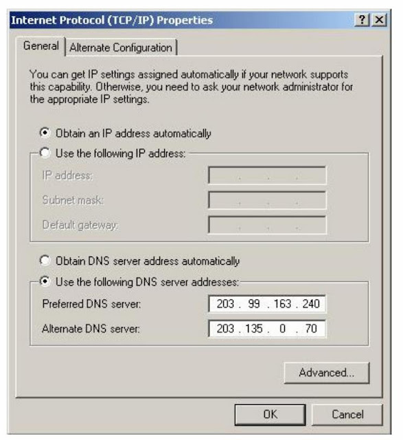 TCP IP PROTOCOL SETTINGS