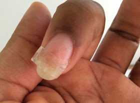 broken nail repair