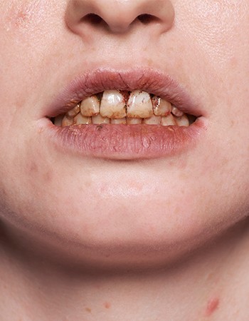 kryolan tooth enamel modena