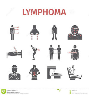   cancer de la lymphe, cancer de la lymphe chance de survie, cancer ganglions lymphatiques chance de survie, cancer lymphatique guerison, cancer de la lymphe stade 4, cancer des ganglions chance de survie, lymphome prise de sang, lymphome stade 4, systeme lymphatique des jambes