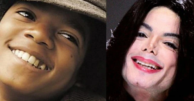 Heartbreaking Testimony: This Is How Michael Jackson's Skin Color Cleared Up