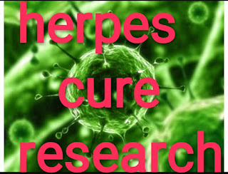 herpes cure research