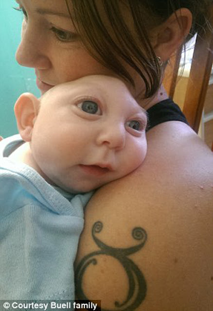  Bayi lahir dengan tengkorak kepala tidak penuh