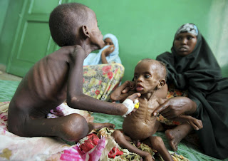imagen de hambre de africa