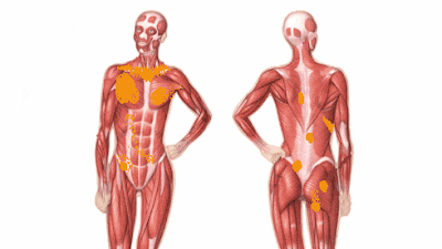 TRIGGER POINTS