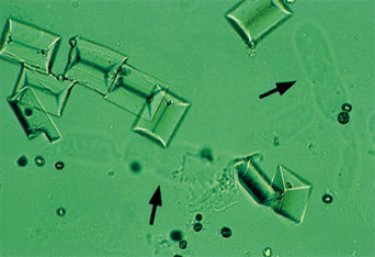 LAB PATOLOGI KLINIK Urinalysis sedimen 