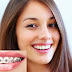 Cách sửa răng khểnh tại các phòng nha