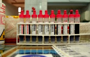 Blood, medical, test tube, laboratory. Stock Photo credit: datarec