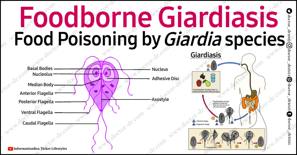 Foodborne Giardiasis- Food Poisoning By Giardia Species