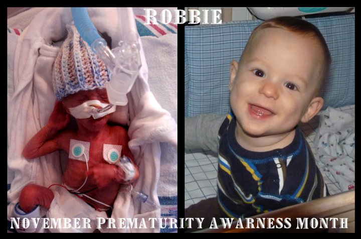 images of babies born at 35 weeks. My nephew Robbie was orn at