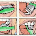 Cara Menggosok Gigi dengan Benar
