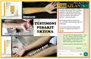 testimoni body solution soap(BSS)