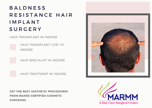 Hair transplant in Indore,