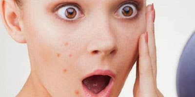 How to Eliminate Black Spot on Face Naturally