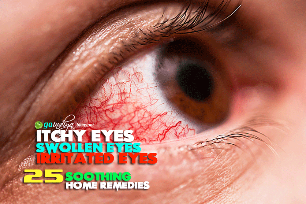 Red, itchy eyes? Home Remedies for Soothing Itchy, Swollen