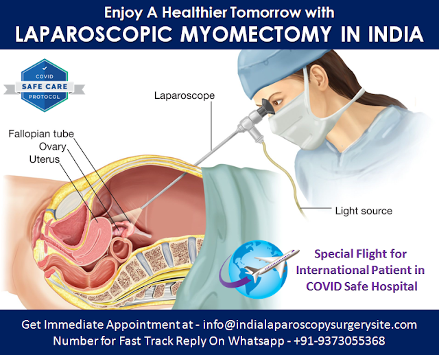 Laparoscopic Myomectomy Surgery in India
