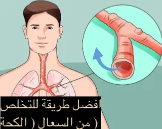 دواء للسعال ( الكحة ) أفضل طريقة بدون أدوية للتخلص من البلغم بالمنزل