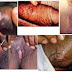 Obat Paling Mujarab Buat Penyakit Sipilis thumbnail