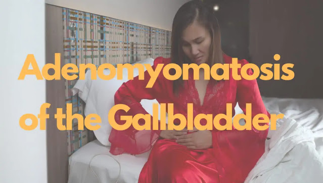 Adenomyomatosis of the Gallbladder: Symptoms and Treatment