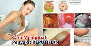 Obat herbal Vagina sakit dan keluar keputihan