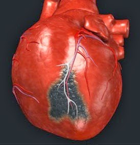 askep sistem cardiovaskuler