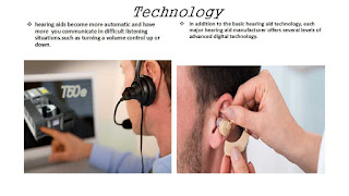 Private Hearing Aids Vs NHS Hearing Aids.