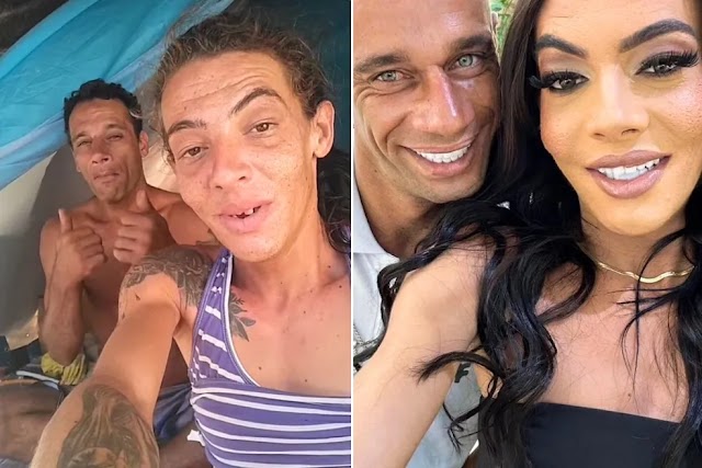 Casal 'maloka' que viralizou mostrando vida nas ruas comemora sorriso novo; veja antes e depois