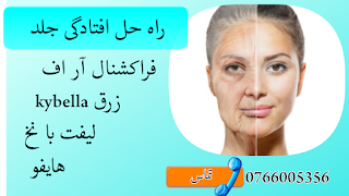 تداوی چملکی حاد و افتادگی جلد 