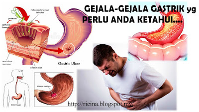 GASTRIK