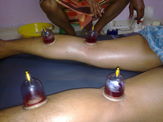 Urut & bekam tradisional