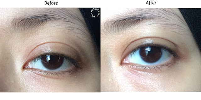 review hasil pemakaian eye serum retinol elsheskin