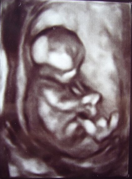 3d ultrasound pictures at 26 weeks. Baby Davy: a 3D ultrasound of