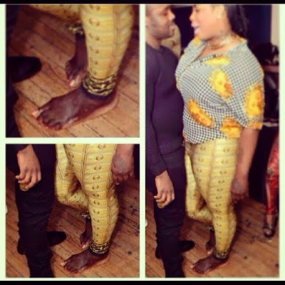 Lol: This Lady Who Forgot To Bleach Her Feet [See Photo]