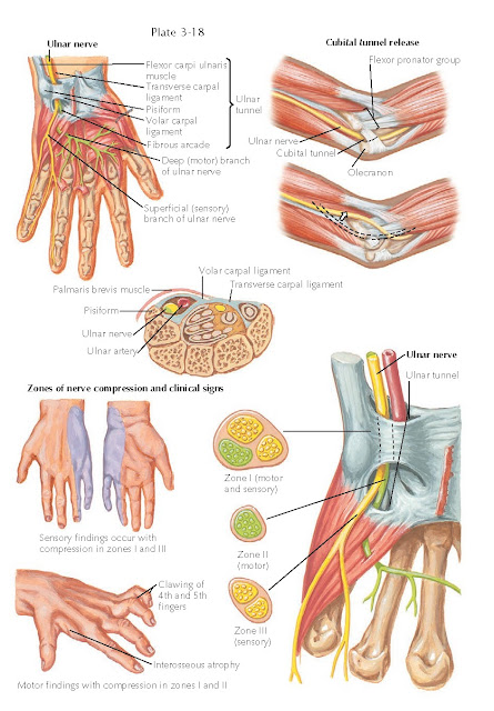 CUBITAL TUNNEL SYNDROME