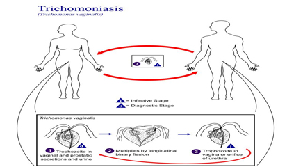 Cara Penularan Trichomanas