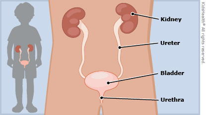 Hematuria: Blood in urine.