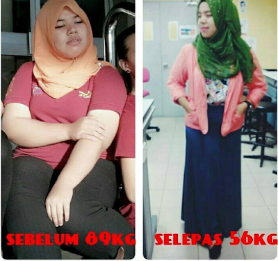 testimoni dz garcinia herbal plus