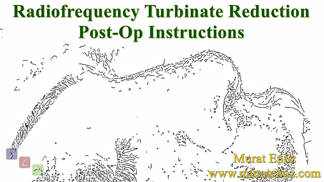 Radiofrequency Turbinate Reduction Post-Op Instructions - Post-Operative Instruction For Radiofrequency Turbinate Reduction - Post-operative Instructions for Turbinate Reduction - Postoperative Instructions for Turbinate Radiofrequency 