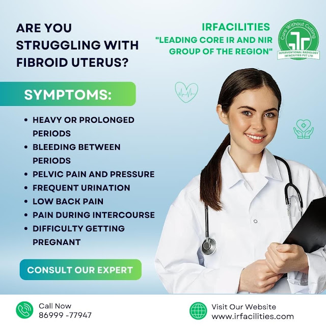 Treatment Of Uterine Fibroids
