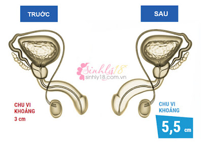 Tăng kích thước dương vật tại nhà nhanh nhất như thế nào