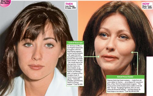 shannen doherty plastic surgery pictures