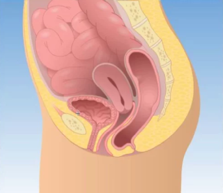 Pelvic Organ Prolapse