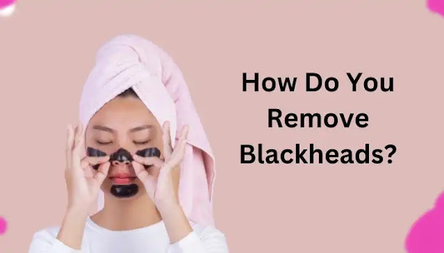 Remove Blackheads