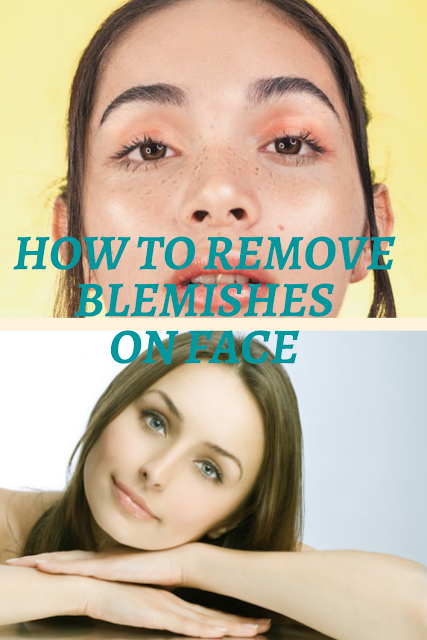 How to Remove Blemishes on Face