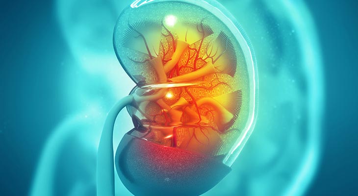 Kidney Stones Treatment In Thane West