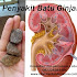 Indikasi Penyakit Kencing Batu