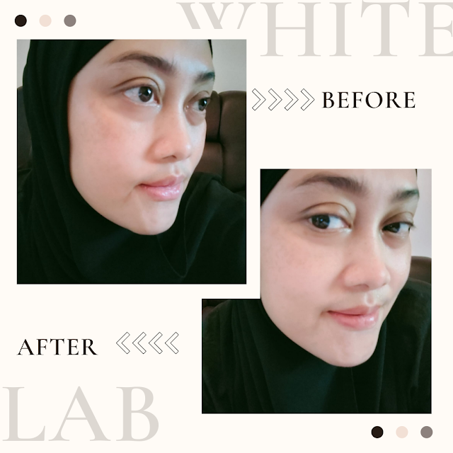 Whitelab Retinol Treatment Serum